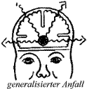 Epilepsie Fokale Und Generalisierte Epileptische Anf Lle Und